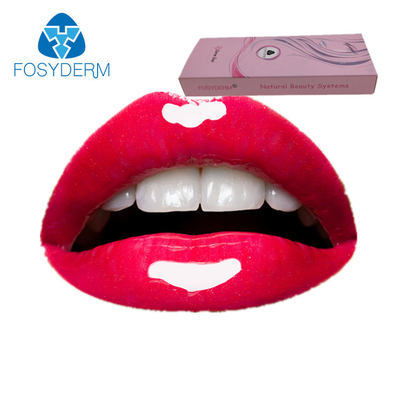 2ml DermのHyaluronic酸の注入口のリドカイン、リドカインが付いている唇の注入の十分HAのゲル