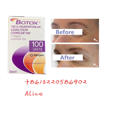反老化する反しわのボツリヌス菌の毒素AllerganはBotoxの粉をタイプする